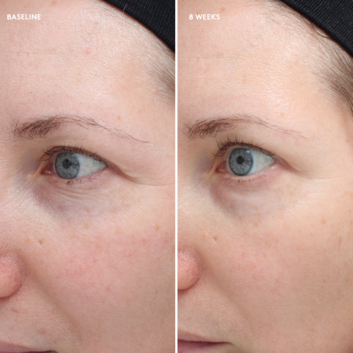 Today’s Deal Total Eye® Firm & Repair Cream - Image 7